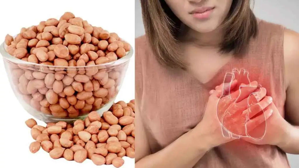 Peanuts And Heart Attack